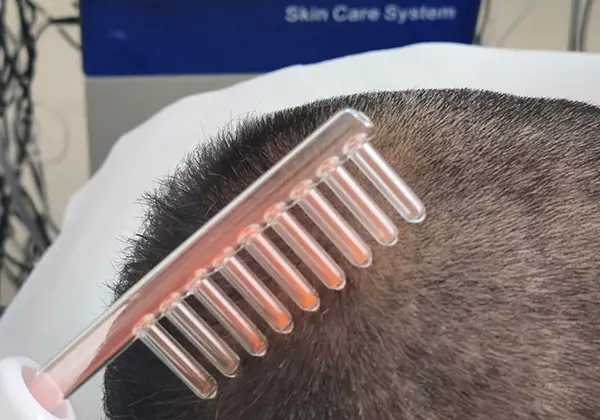 Tratamientos Clínica Mulet. Unidad capilar. Puerto de Sagunto (Valencia).