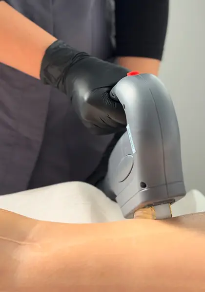 Tratamientos Clínica Mulet. Depilación láser. Puerto de Sagunto (Valencia).